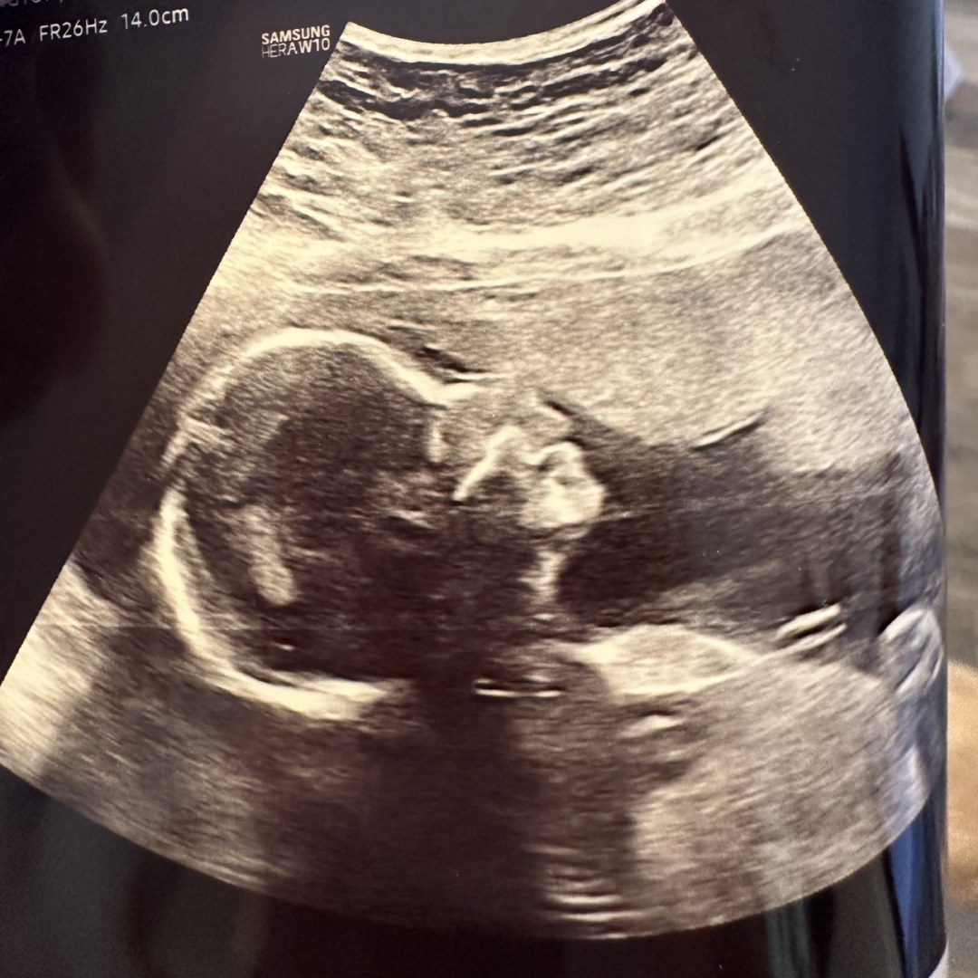 Photo shared by Jasmine for their Babylist baby registry.