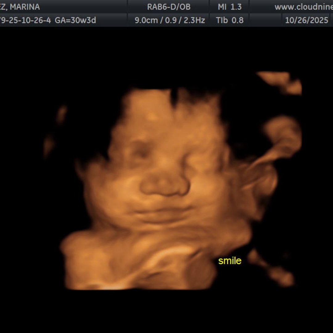 Photo shared by Marina for their Babylist baby registry.