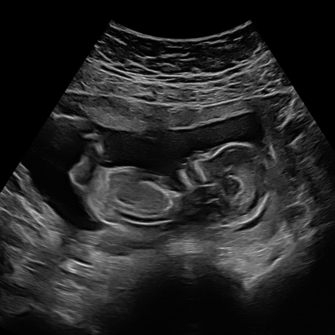 Photo shared by Indiana for their Babylist baby registry.