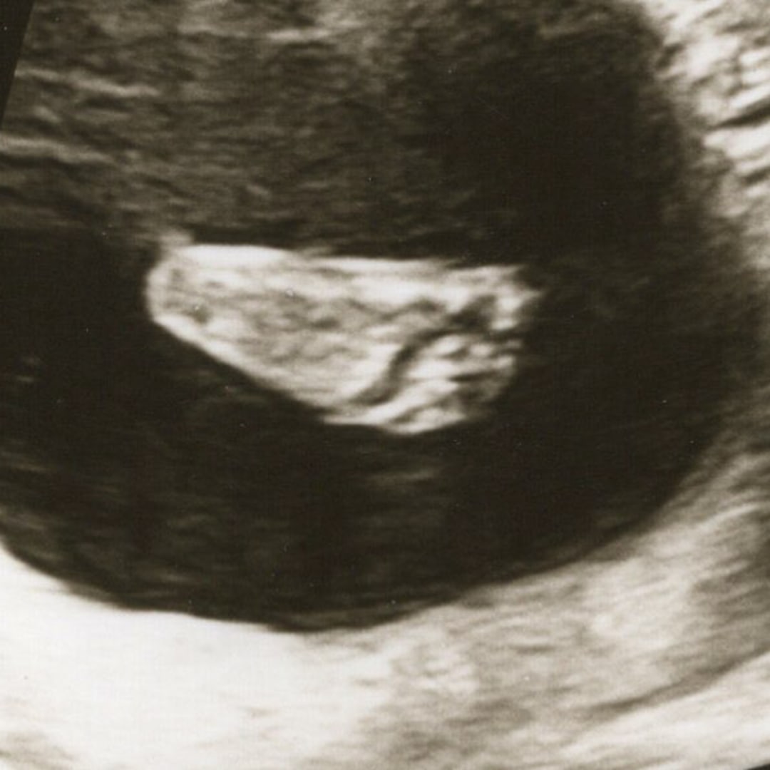 Photo shared by Hannah for their Babylist baby registry.