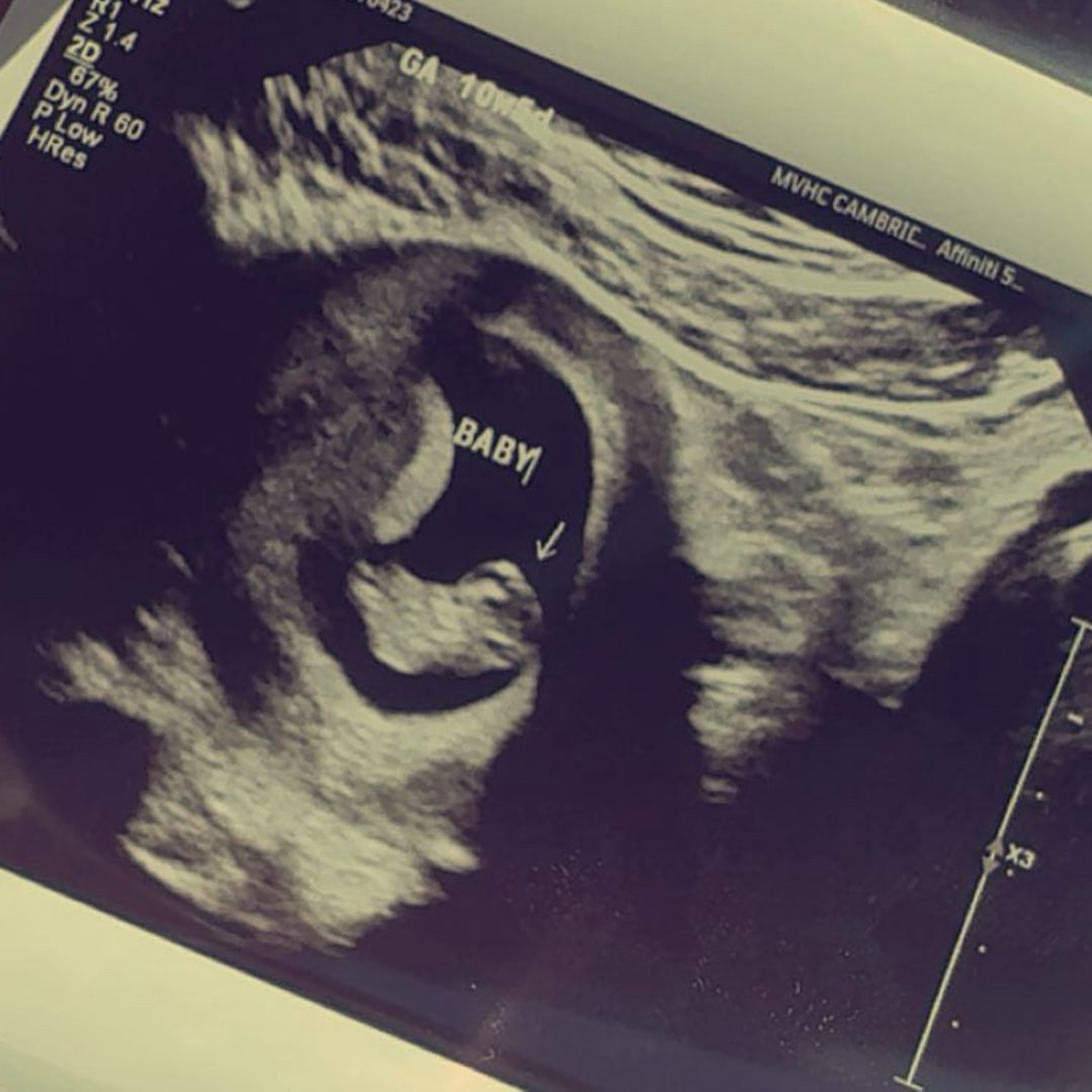 Photo shared by IZABEL for their Babylist baby registry.