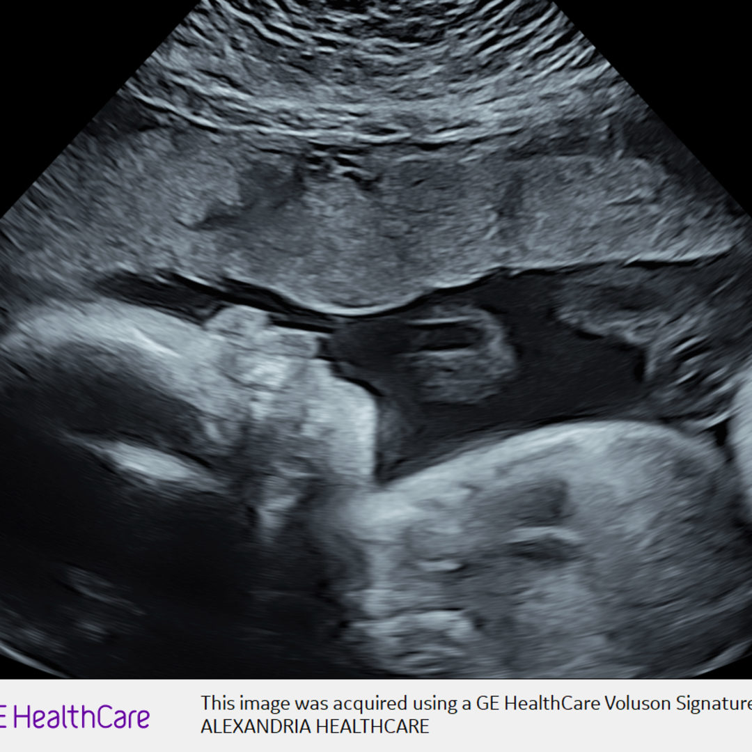 Photo shared by Balee for their Babylist baby registry.