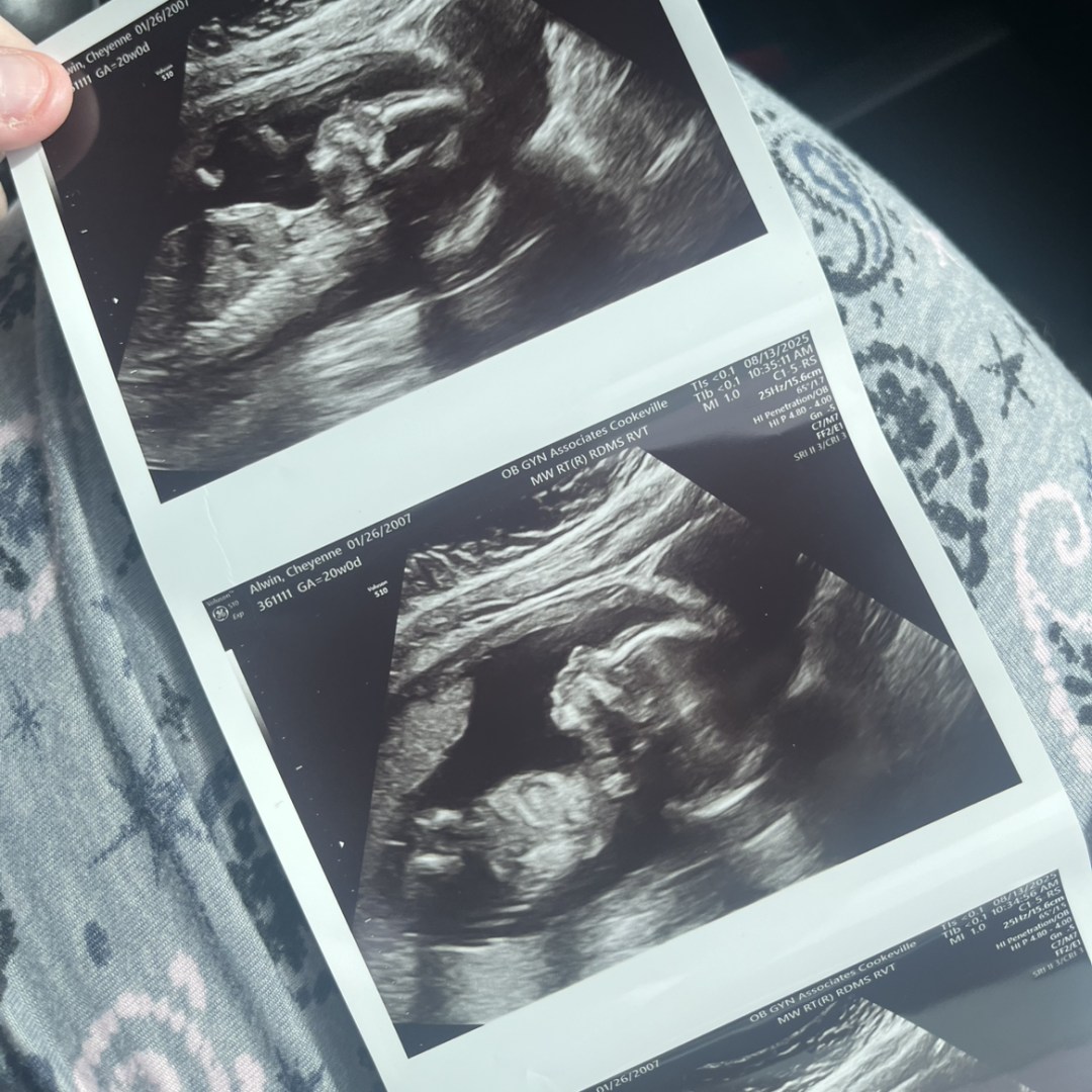 Photo shared by Cheyenne for their Babylist baby registry.