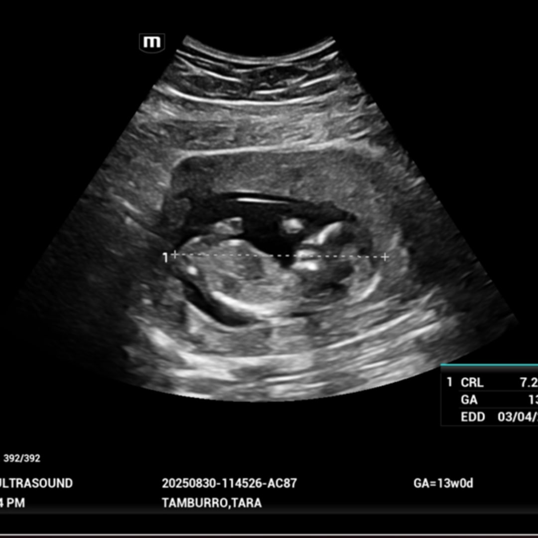 Photo shared by Tara for their Babylist baby registry.