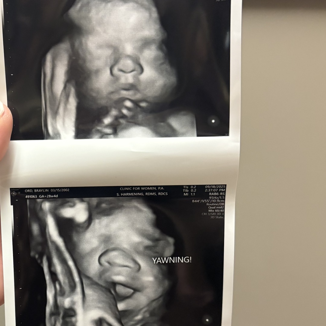Photo shared by Braylin for their Babylist baby registry.
