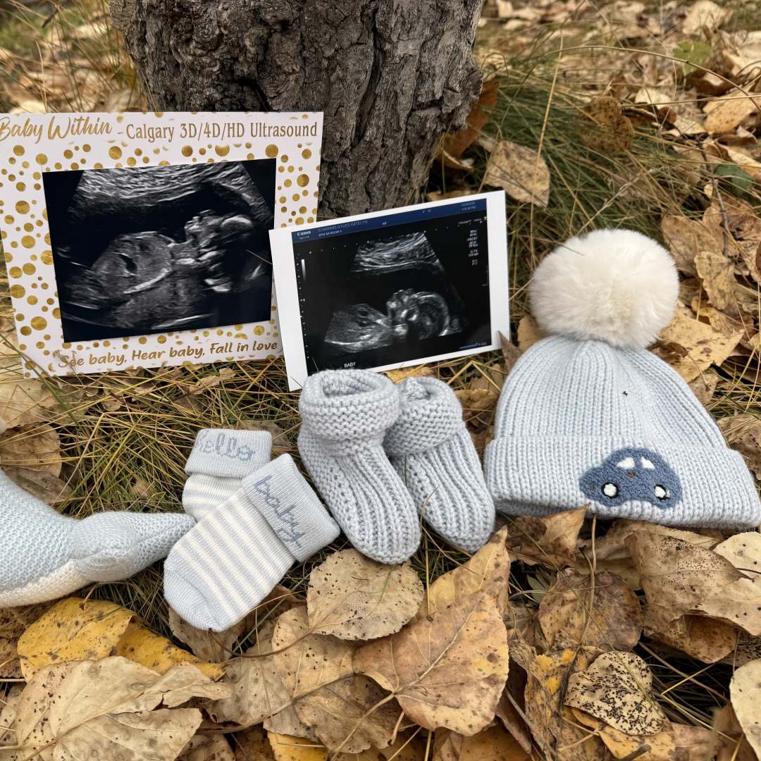 Photo shared by Katelyn for their Babylist baby registry.