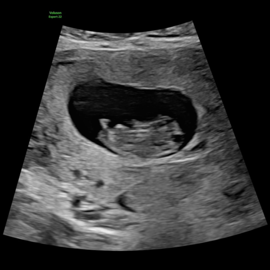 Photo shared by Lynsey for their Babylist baby registry.