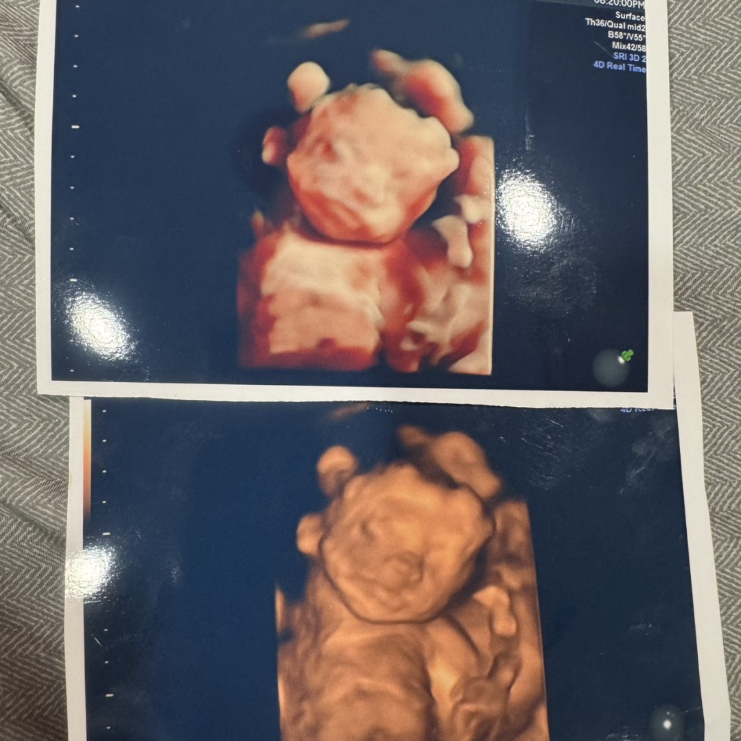 Photo shared by Yazlyn for their Babylist baby registry.