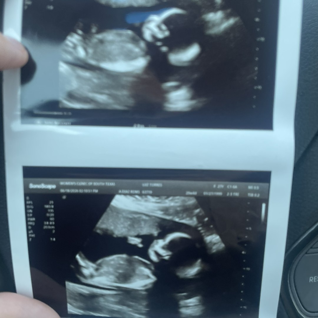 Photo shared by Luz for their Babylist baby registry.