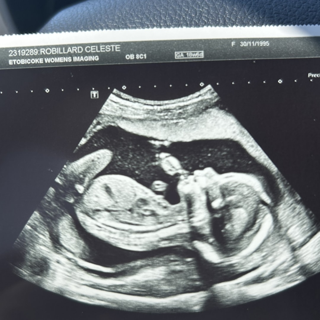 Photo shared by Celeste for their Babylist baby registry.