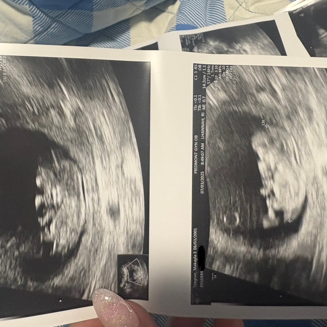 Photo shared by Makayla for their Babylist baby registry.