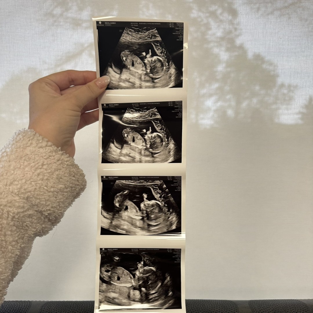 Photo shared by Audrey for their Babylist baby registry.