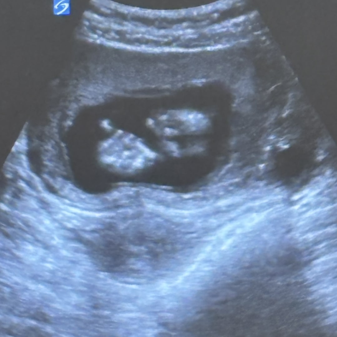 Photo shared by Hailey for their Babylist baby registry.