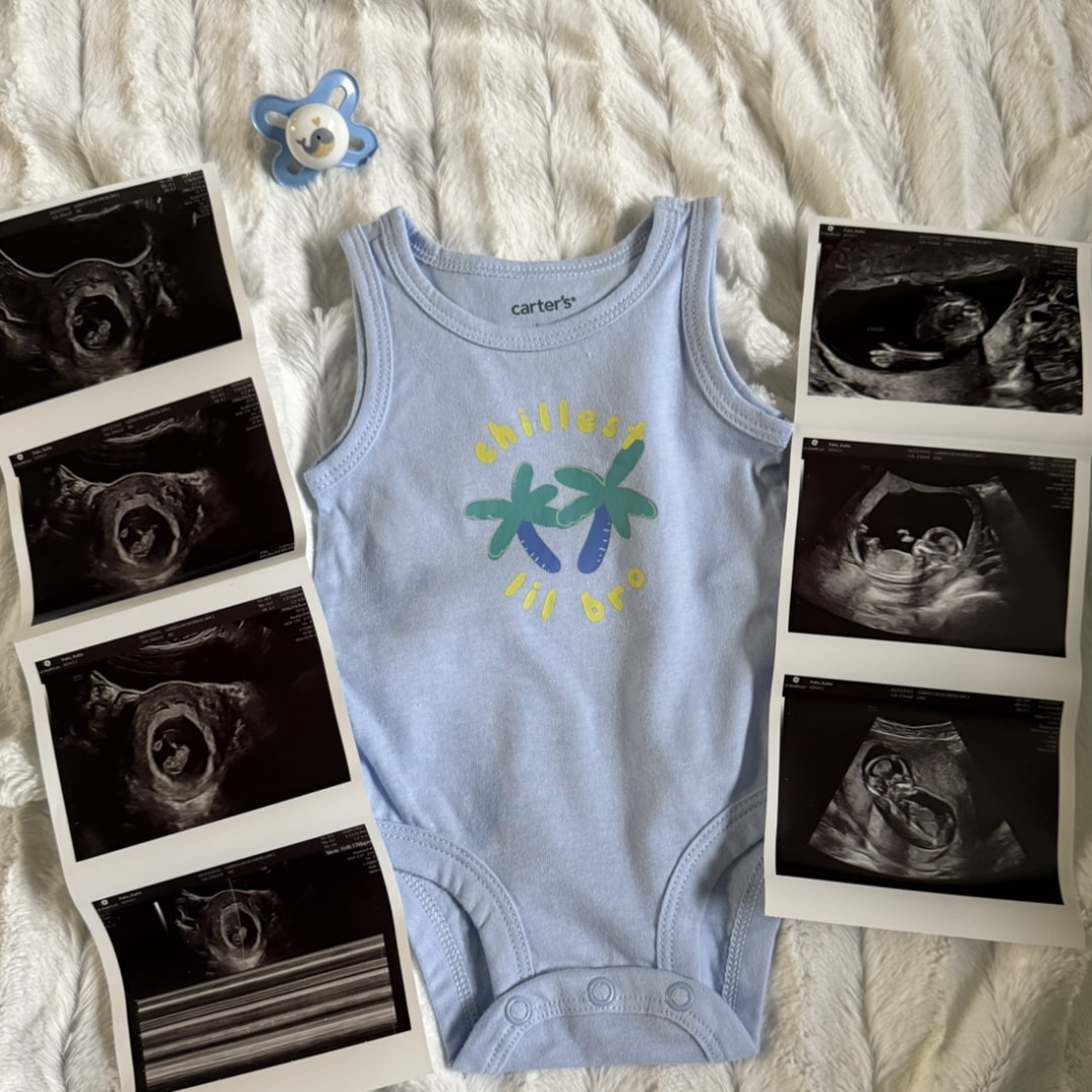 Photo shared by Katie for their Babylist baby registry.