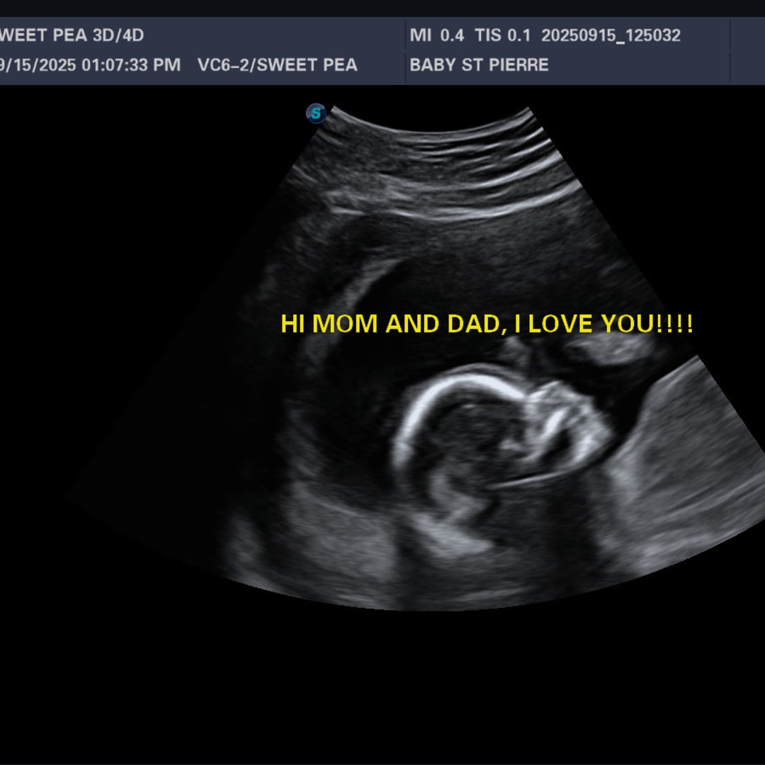 Photo shared by Regan for their Babylist baby registry.