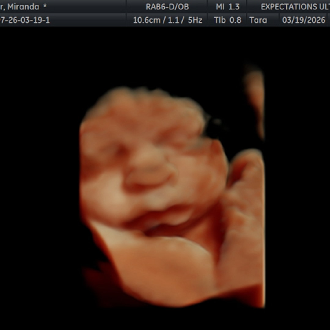 Photo shared by Miranda for their Babylist baby registry.