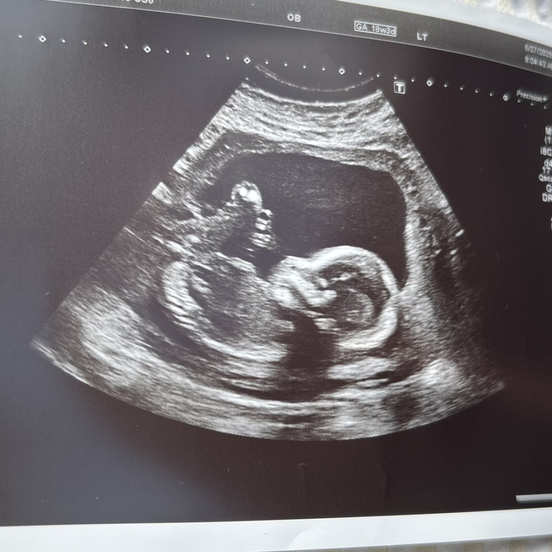 Photo shared by Melissa for their Babylist baby registry.
