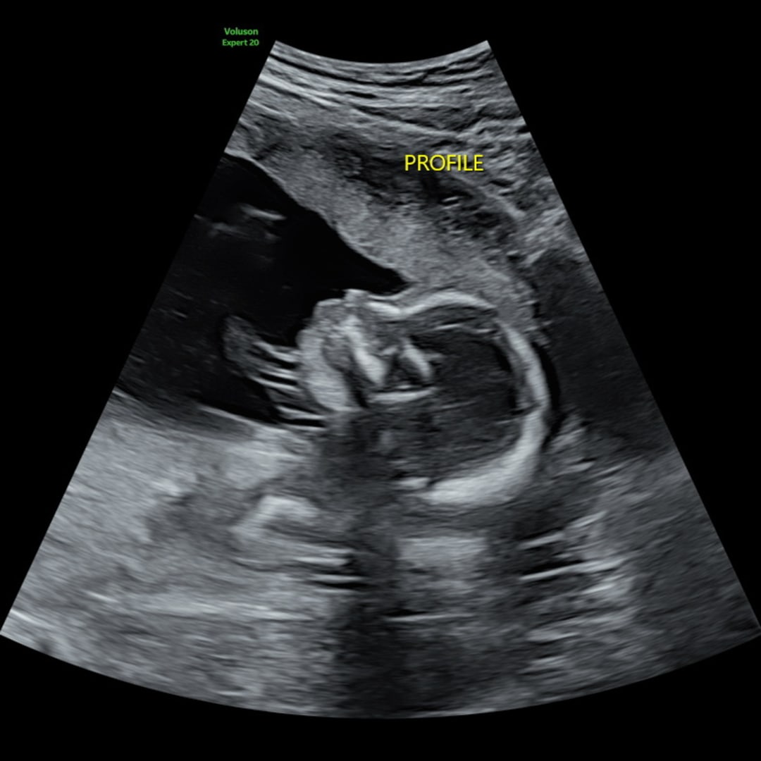 Photo shared by Hannah for their Babylist baby registry.