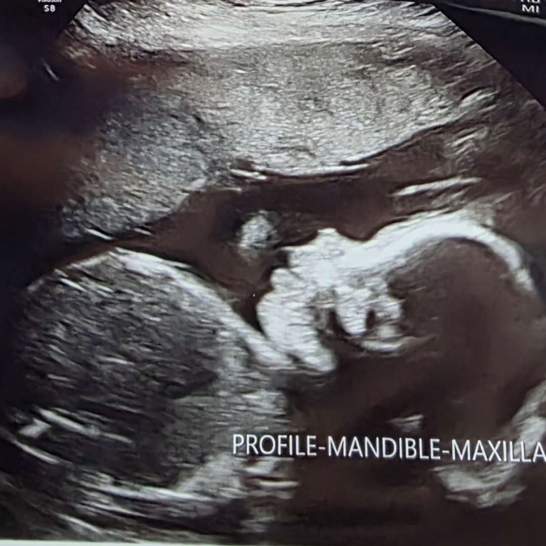 Photo shared by Brittany for their Babylist baby registry.