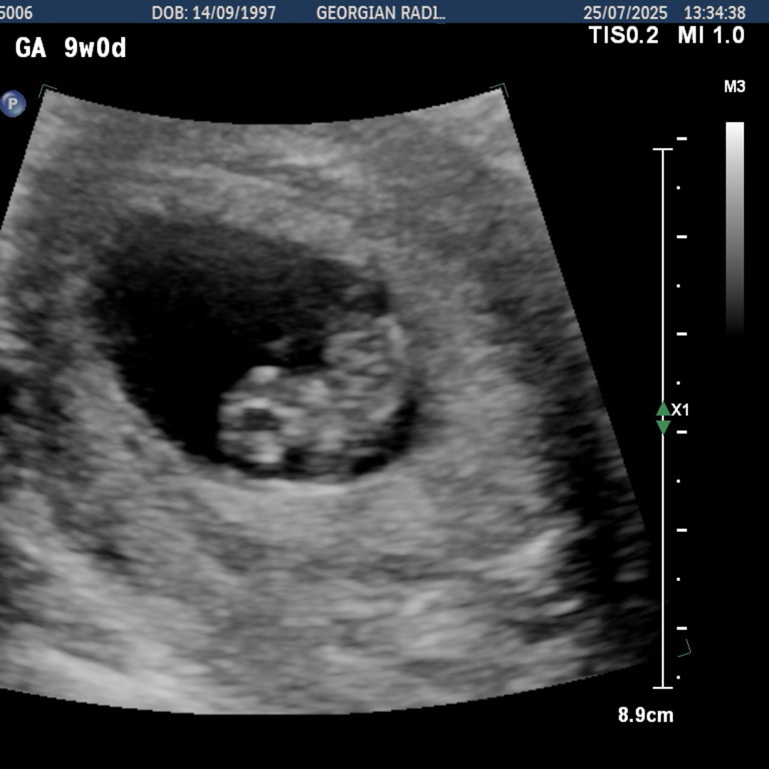 Photo shared by Iva for their Babylist baby registry.