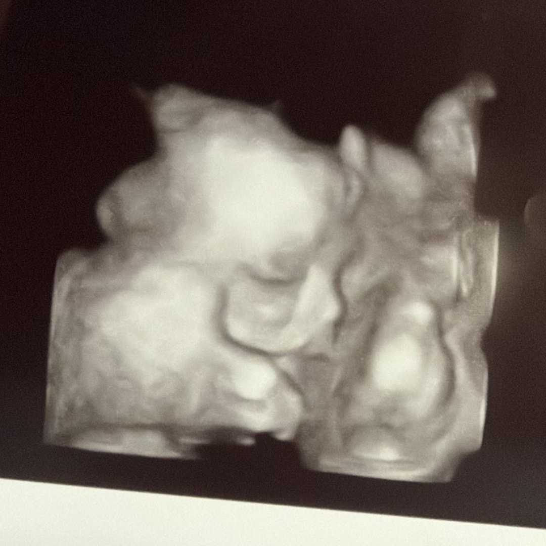 Photo shared by Taylor for their Babylist baby registry.