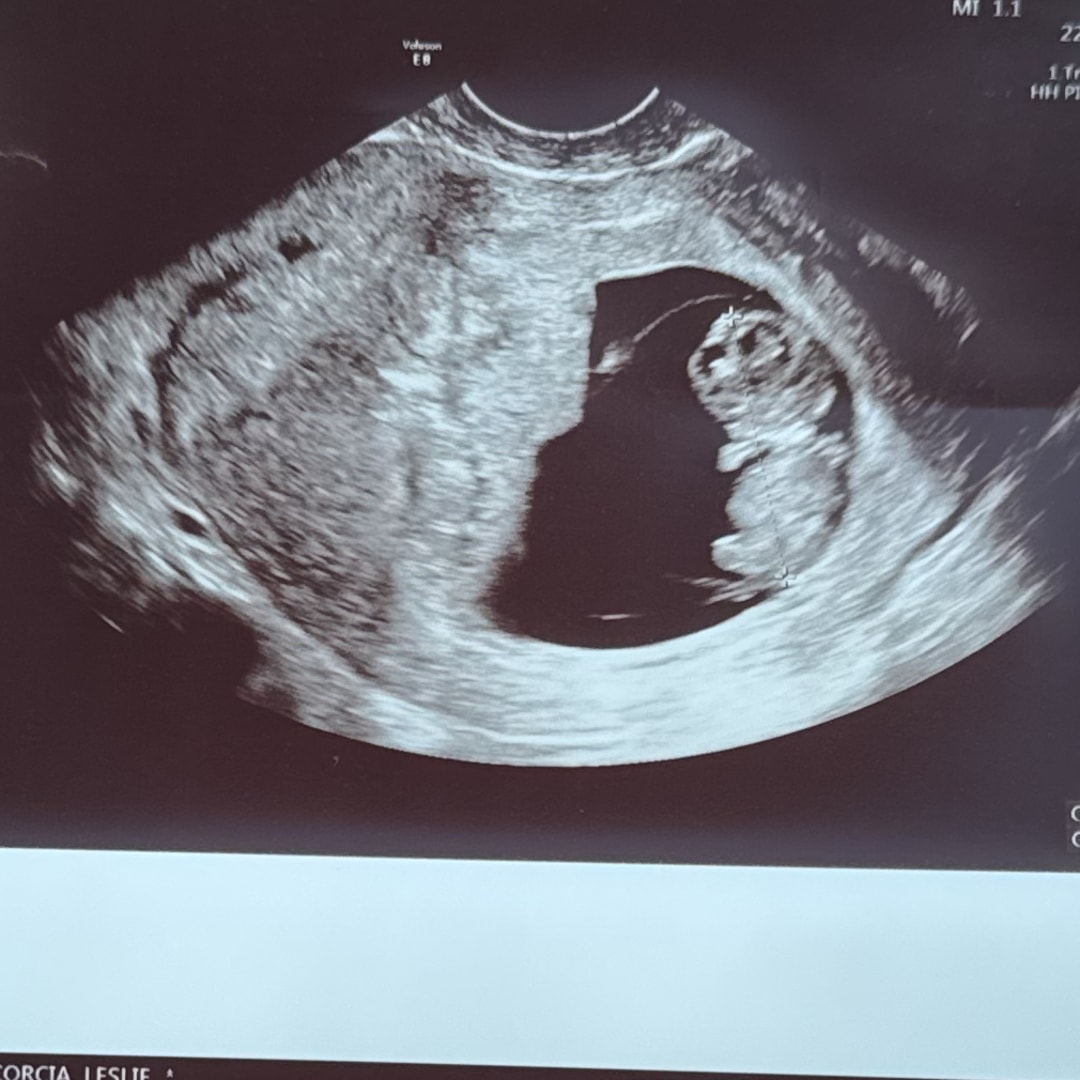 Photo shared by Stephanie for their Babylist baby registry.