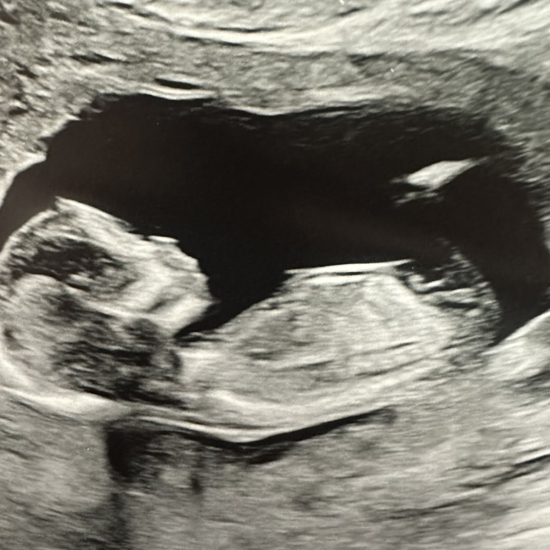 Photo shared by Brittany for their Babylist baby registry.