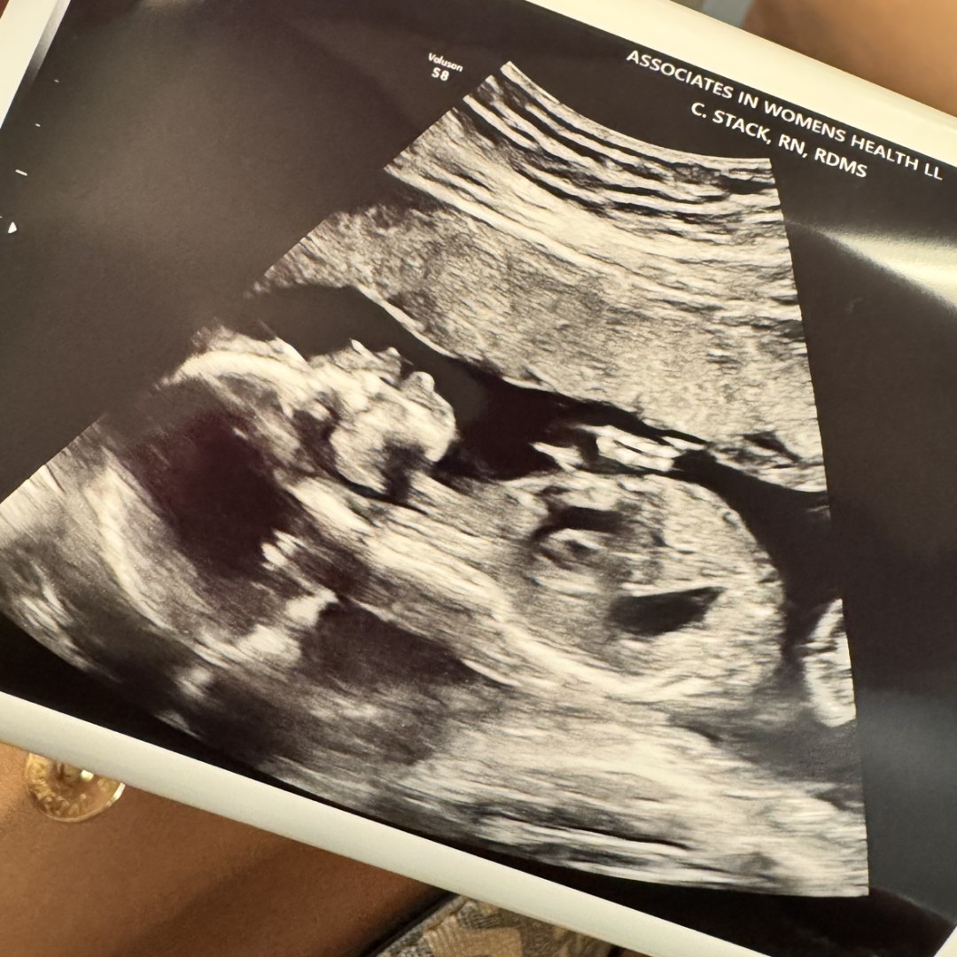 Photo shared by Arriauna for their Babylist baby registry.