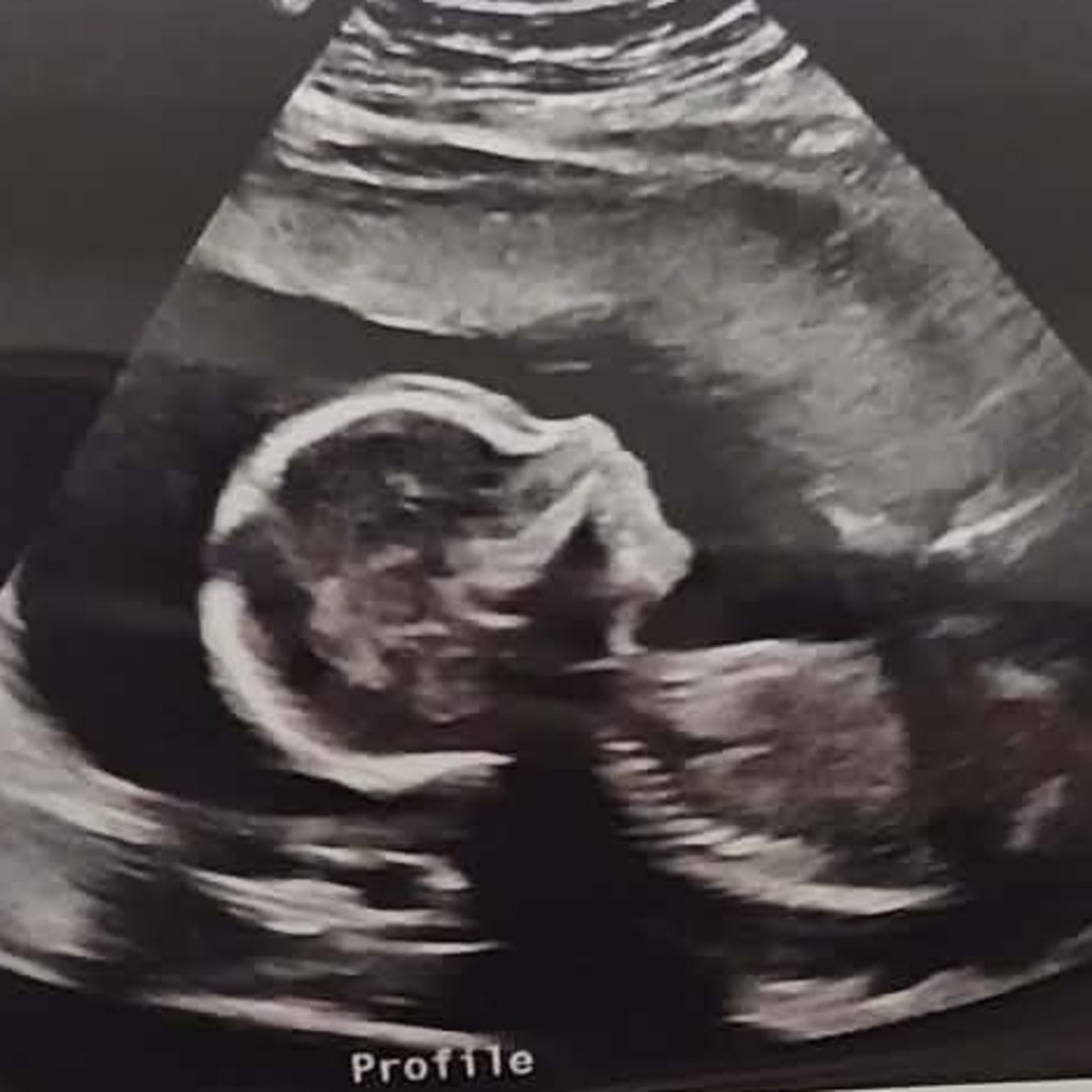 Photo shared by Elizabeth for their Babylist baby registry.