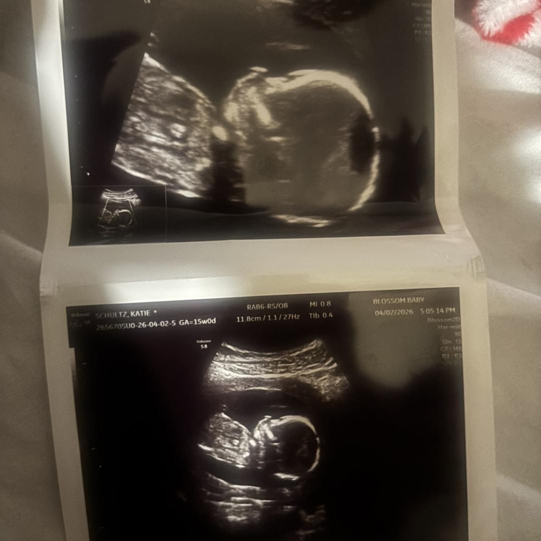 Photo shared by Katie for their Babylist baby registry.