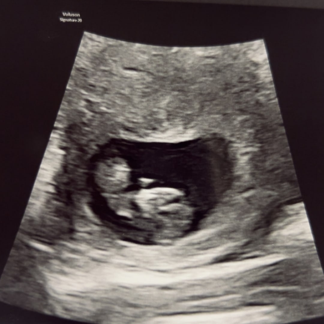 Photo shared by McKenzie for their Babylist baby registry.