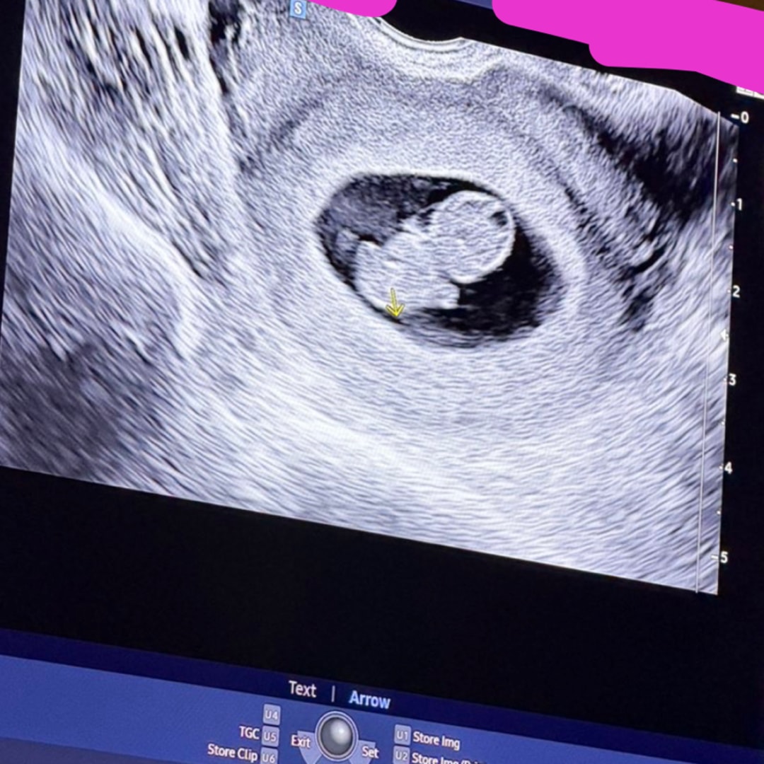 Photo shared by Cathryn for their Babylist baby registry.