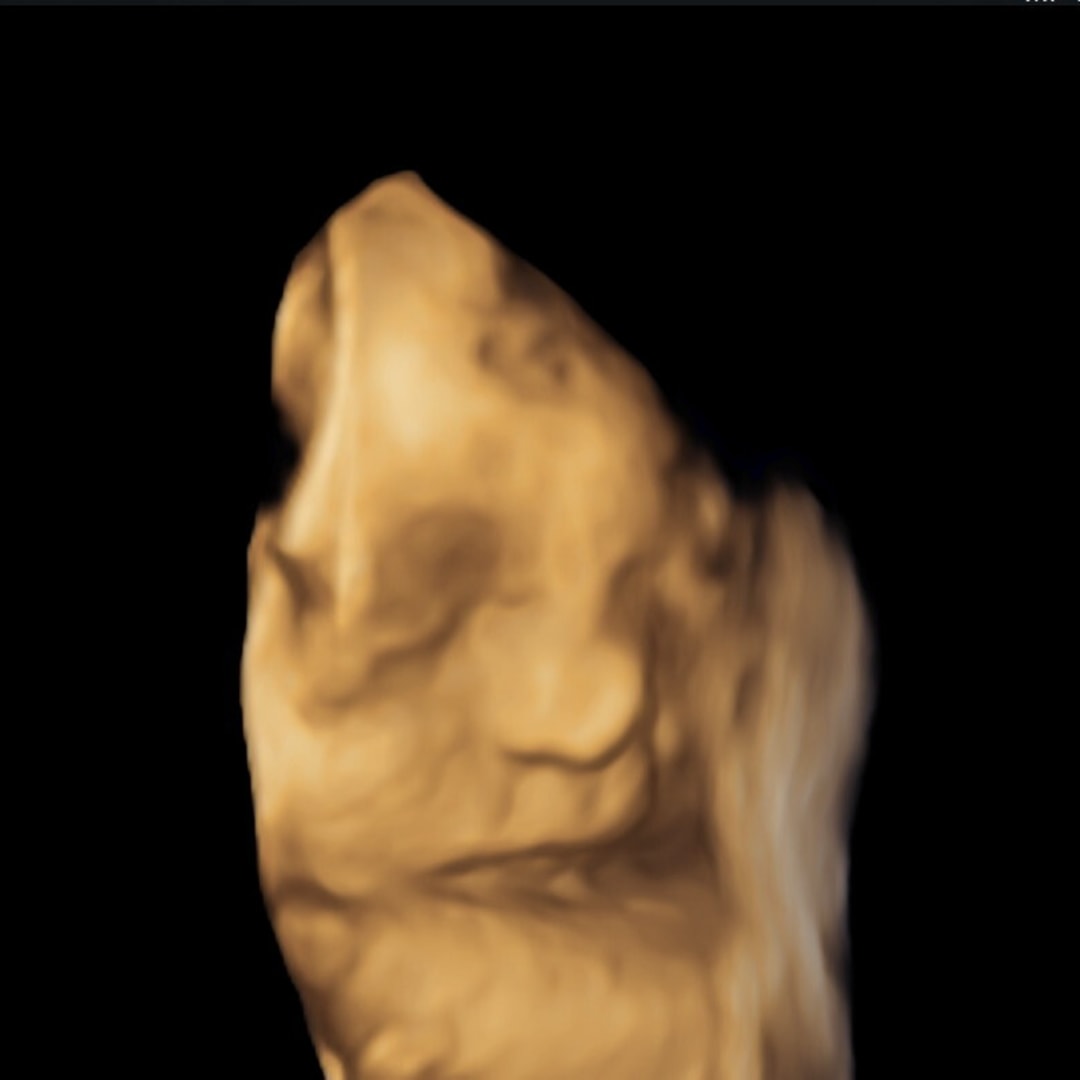 Photo shared by Aryanna for their Babylist baby registry.