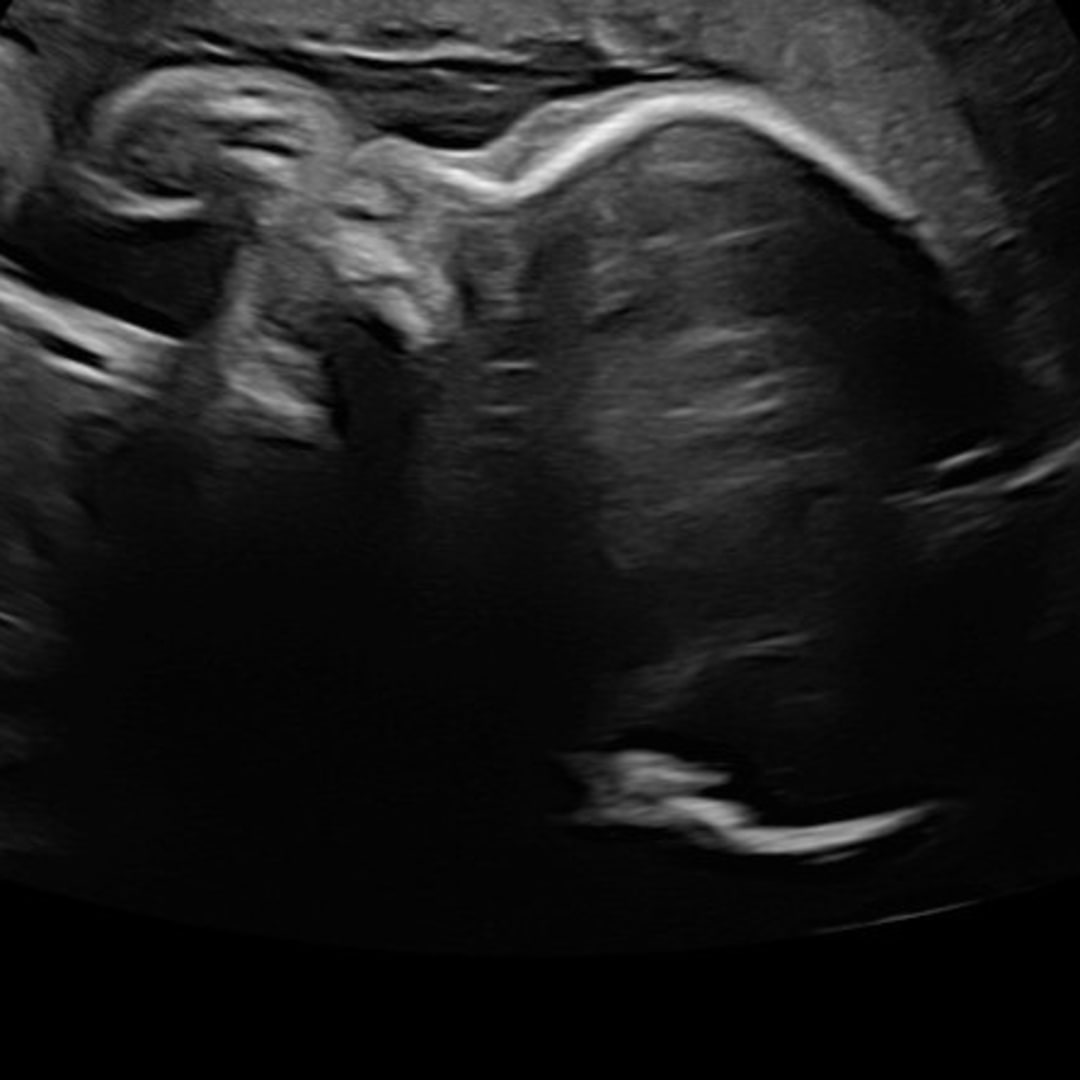 Photo shared by Alexa for their Babylist baby registry.