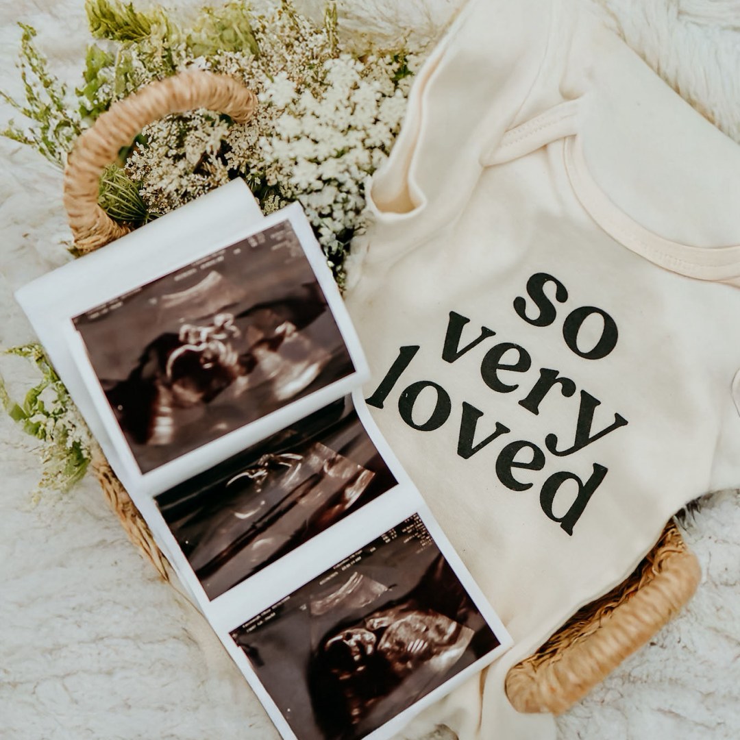 Photo shared by Olivia for their Babylist baby registry.