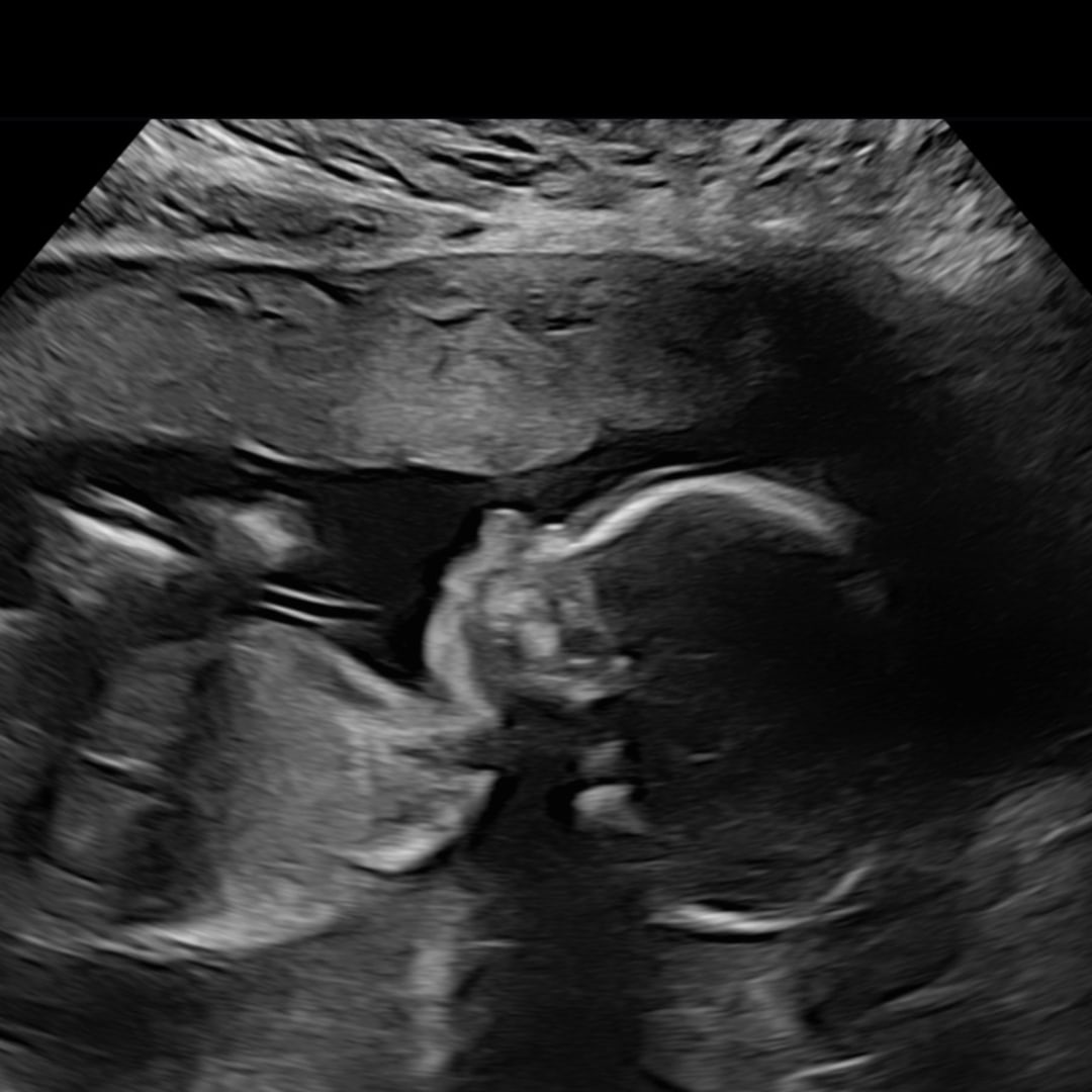 Photo shared by Alexis for their Babylist baby registry.