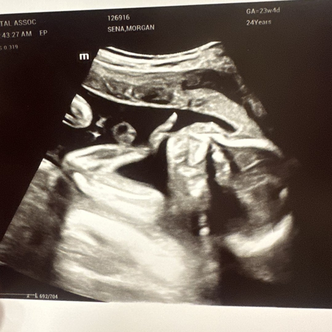 Photo shared by Morgan for their Babylist baby registry.
