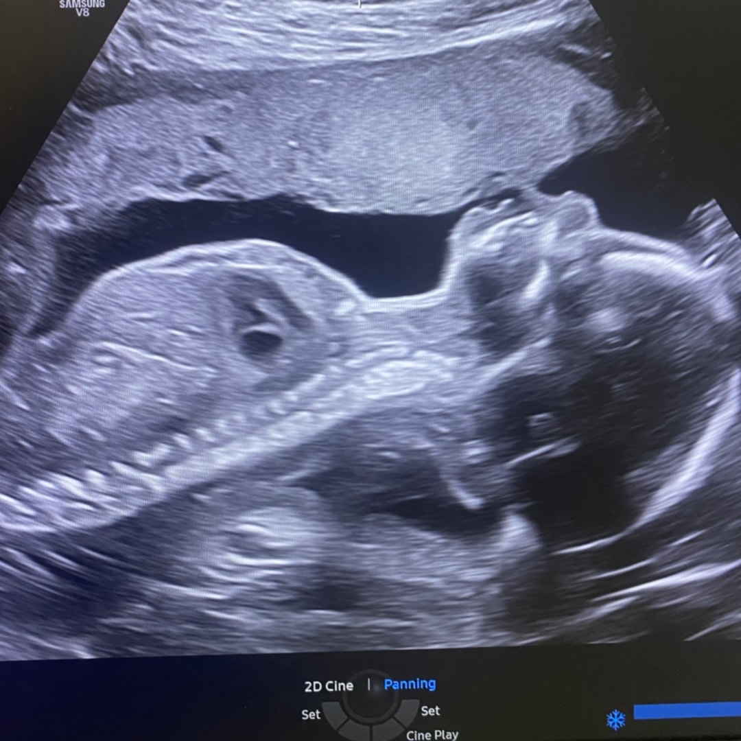 Photo shared by Cozzette for their Babylist baby registry.
