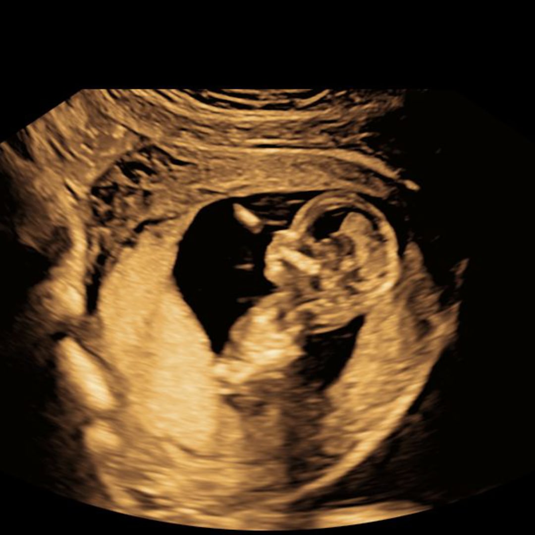 Photo shared by Ellie for their Babylist baby registry.