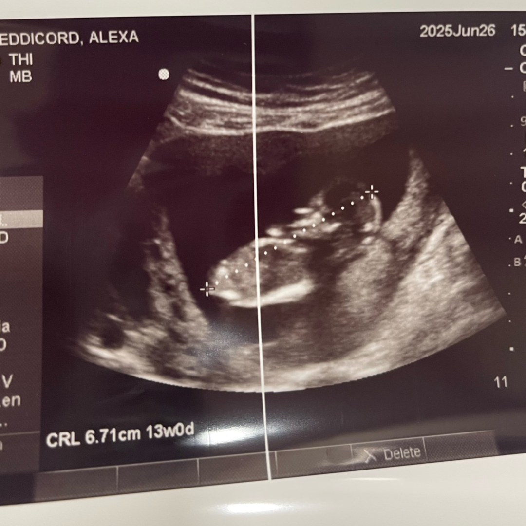 Photo shared by Alexa for their Babylist baby registry.