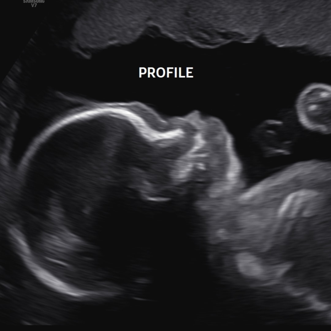 Photo shared by Emma for their Babylist baby registry.