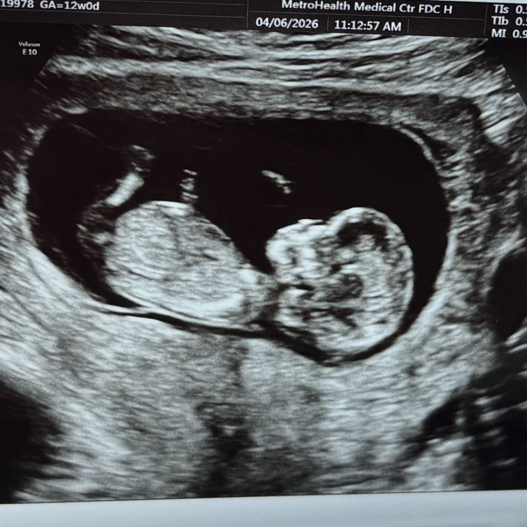 Photo shared by Ebanya (Abby) for their Babylist baby registry.