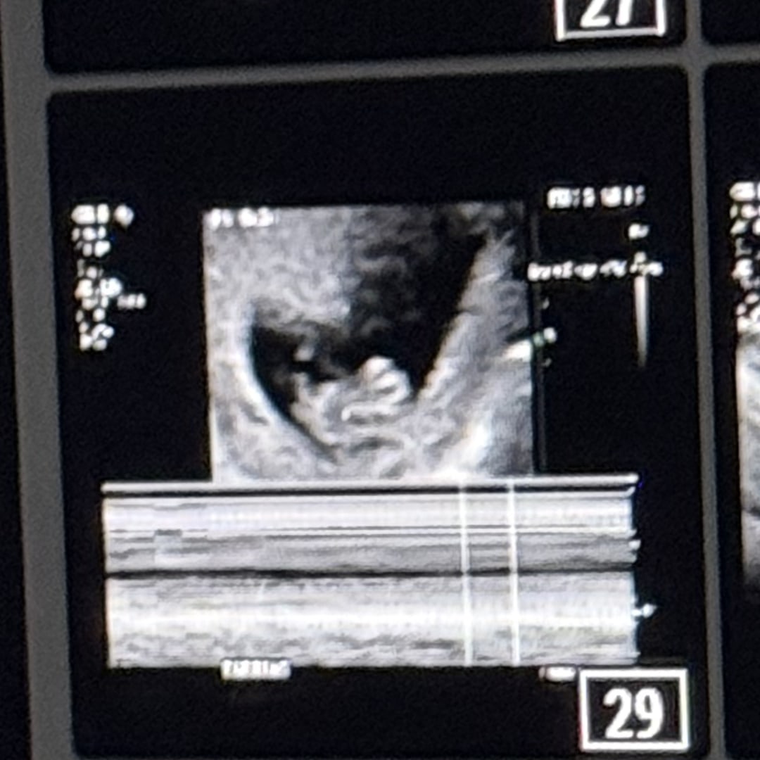 Photo shared by Dailyn for their Babylist baby registry.