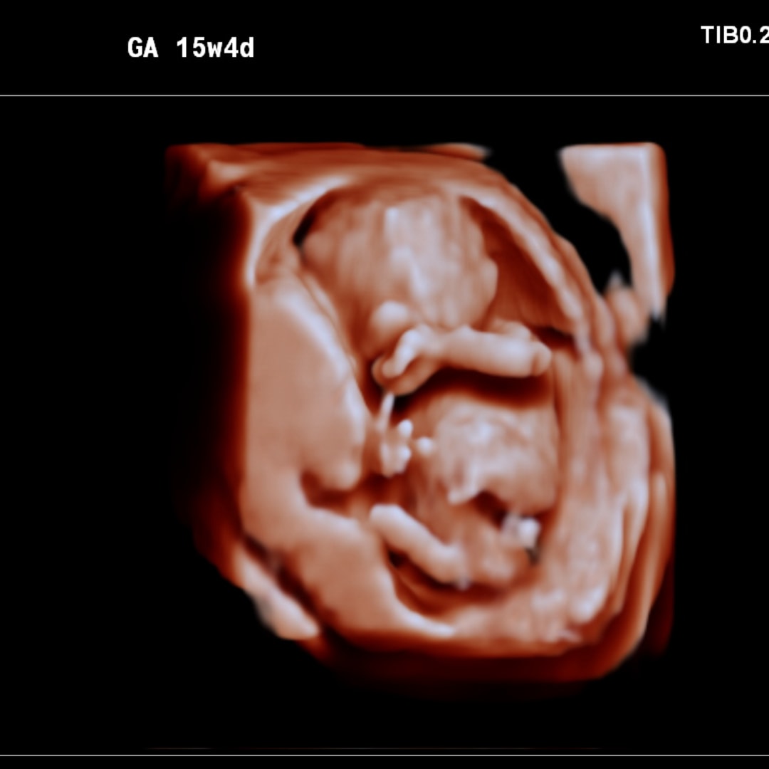 Photo shared by Nikita for their Babylist baby registry.