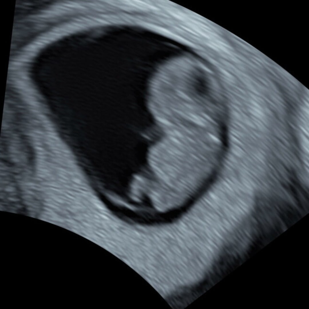 Photo shared by Haley for their Babylist baby registry.