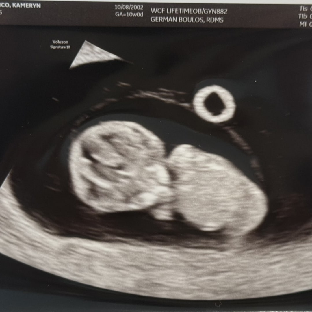 Photo shared by Kameryn for their Babylist baby registry.