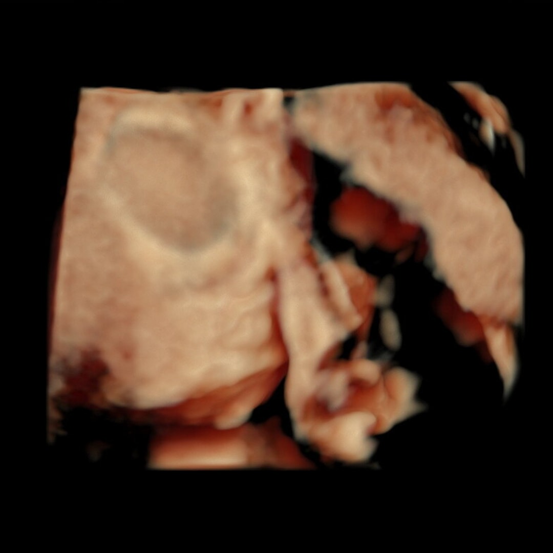 Photo shared by Diana for their Babylist baby registry.