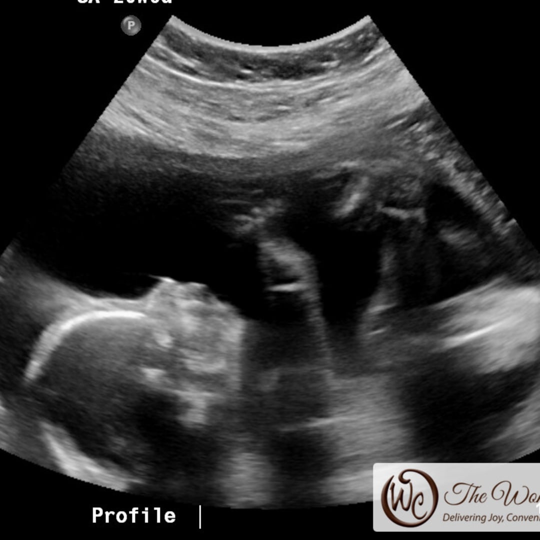 Photo shared by Ashley for their Babylist baby registry.