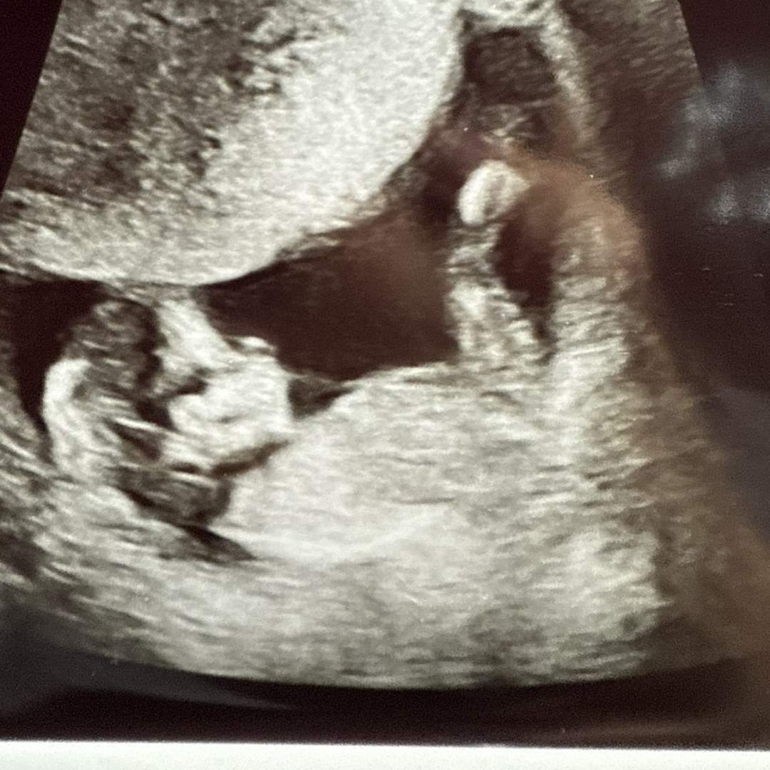 Photo shared by Marissa for their Babylist baby registry.