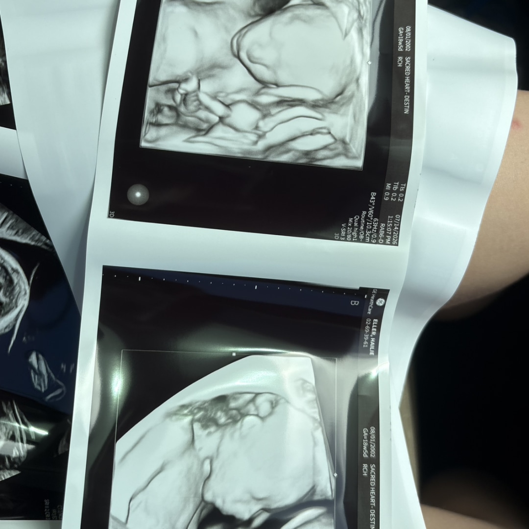 Photo shared by Hailie for their Babylist baby registry.